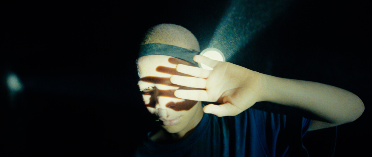 The Boy with White Skin