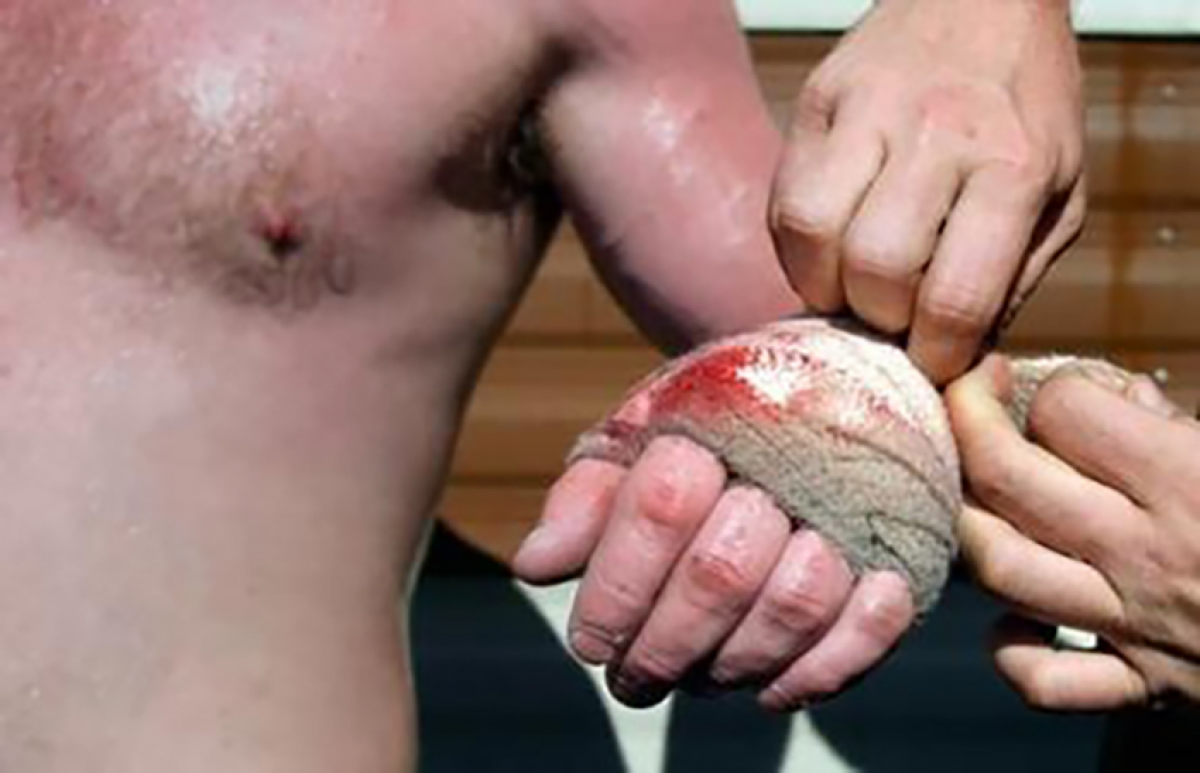 Knuckle